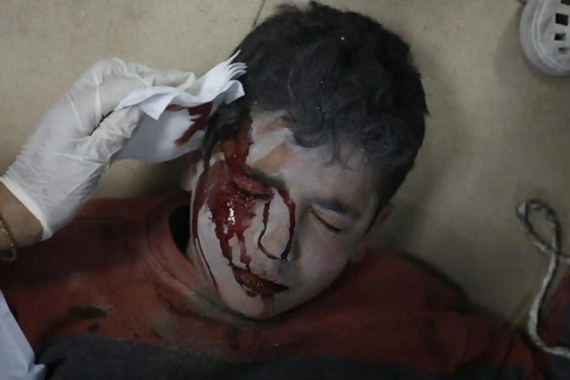 Gaza Under Bombing: Highlights of Day 166